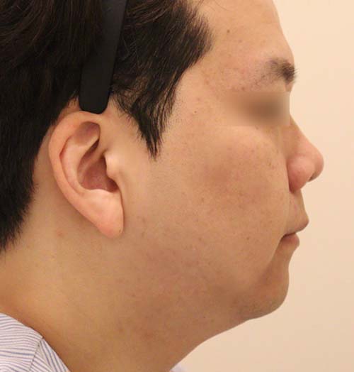 치료 전 이미지
