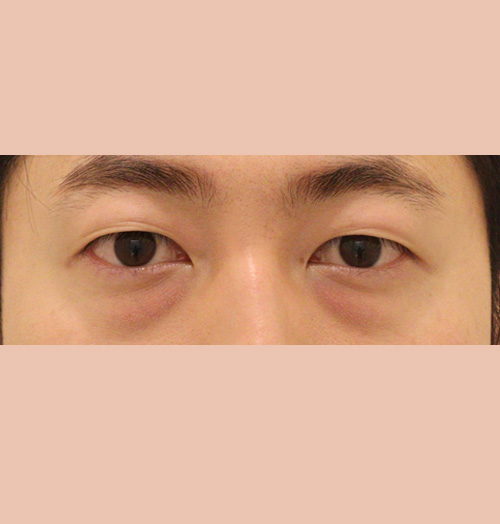 치료 전 이미지