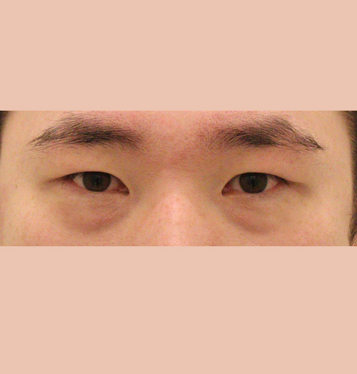 치료 전 이미지