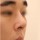 치료 후 이미지
