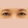 치료 후 이미지