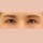 치료 후 이미지