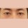 치료 후 이미지
