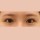 치료 후 이미지