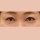 치료 후 이미지