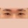 치료 후 이미지