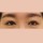 치료 후 이미지